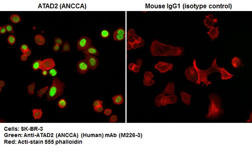 Anti-ATAD2 (ANCCA) (Human) mAb (Clone: C20-19)