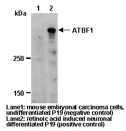 Anti-ATBF1 (D1-120) (Human) pAb