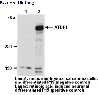 Anti-ATBF1 (AT-6) (Human) pAb