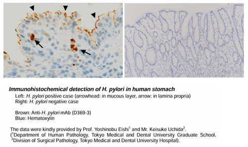 Anti-H.pylori mAb