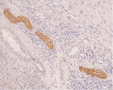 Anti-Neuron-specific enolase (NSE) pAb
