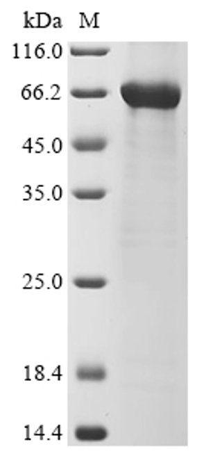 (Tris-Glycine gel) Discontinuous SDS-PAGE (reduced) with 5% enrichment gel and 15% separation gel. (Tris-Glycine gel) Discontinuous SDS-PAGE (reduced) with 5% enrichment gel and 15% separation gel.