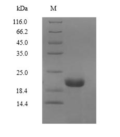 (Tris-Glycine gel) Discontinuous SDS-PAGE (reduced) with 5% enrichment gel and 15% separation gel. (Tris-Glycine gel) Discontinuous SDS-PAGE (reduced) with 5% enrichment gel and 15% separation gel.