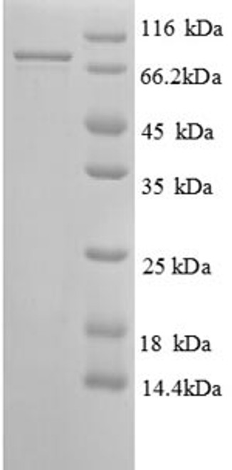 Recombinant Human 26S proteasome non-ATPase regulatory subunit 11 (PSMD11) (CSB-EP018901HUe0)