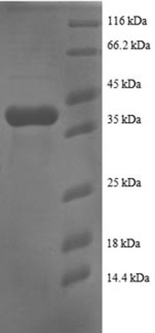 Recombinant Human Small ribosomal subunit protein eS25 (RPS25) (CSB-EP020406HU)
