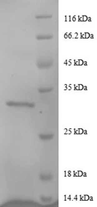Recombinant Human Agouti-related protein (AGRP) (CSB-EP001462HU(A4))