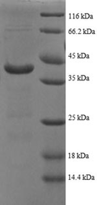 Recombinant Human ATP synthase subunit delta, mitochondrial (ATP5F1D), partial (CSB-EP002355HU1)