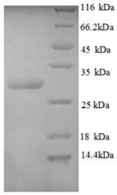 Recombinant Human Calcitonin gene-related peptide 1 (CALCA), partial (CSB-EP153444HU1)