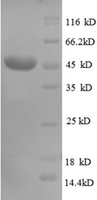 Recombinant Human CD320 antigen (CD320), partial (CSB-EP865096HU1)