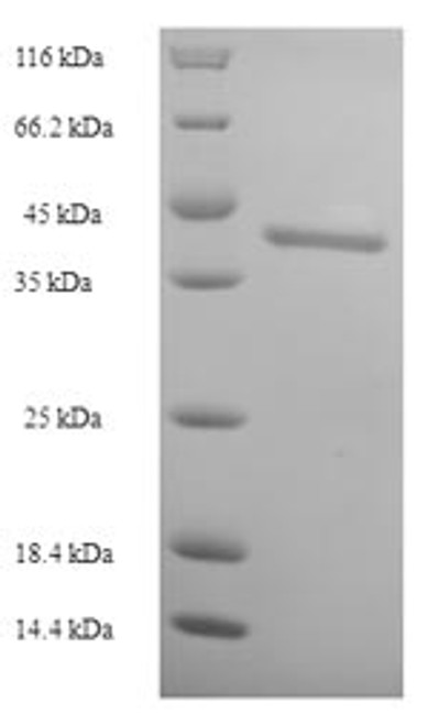 Recombinant Human Dynamin-1 (DNM1), partial (CSB-EP007062HU)