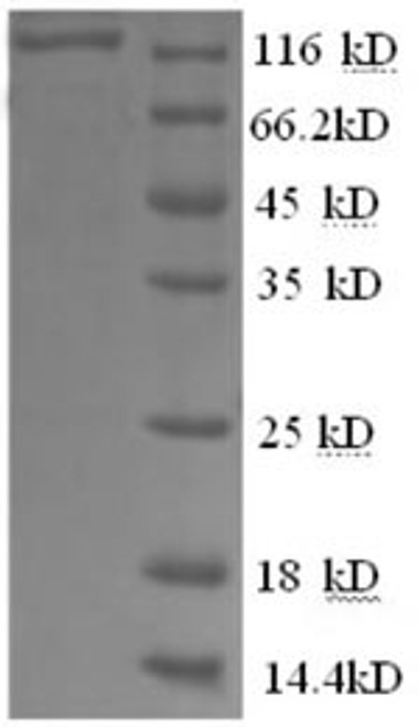 Recombinant Human Glycogen phosphorylase, brain form (PYGB), partial (CSB-EP019120HU)