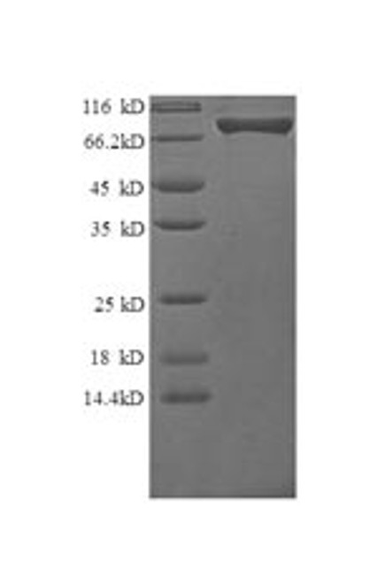 Recombinant Human Granulocyte colony-stimulating factor receptor (CSF3R), partial (CSB-EP860321HU1)
