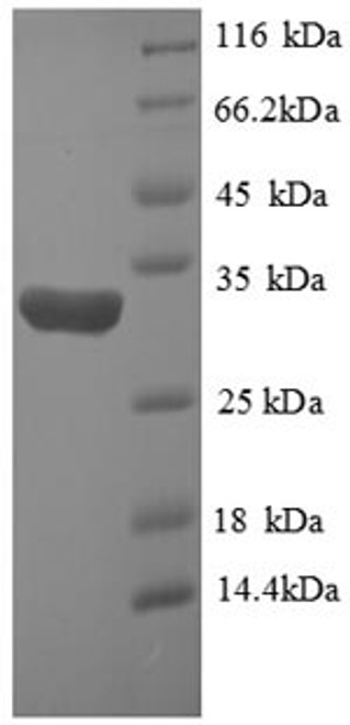 Recombinant Human Hypoxia-inducible factor 1-alpha (HIF1A), partial (CSB-EP624113HU)