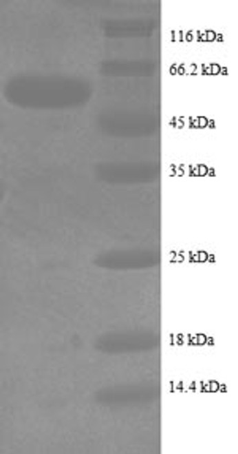 Recombinant Human Intestinal-type alkaline phosphatase (ALPI), partial (CSB-EP001627HU1)