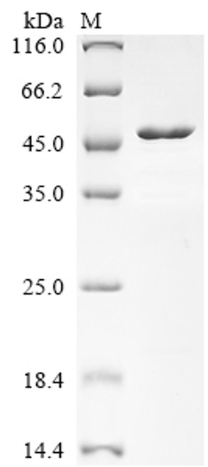 Recombinant Human Kit ligand (KITLG), partial (CSB-MP002061HU1h6)