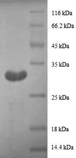 Recombinant Human Metallothionein-1G (MT1G), partial (CSB-EP015113HU1(F2))