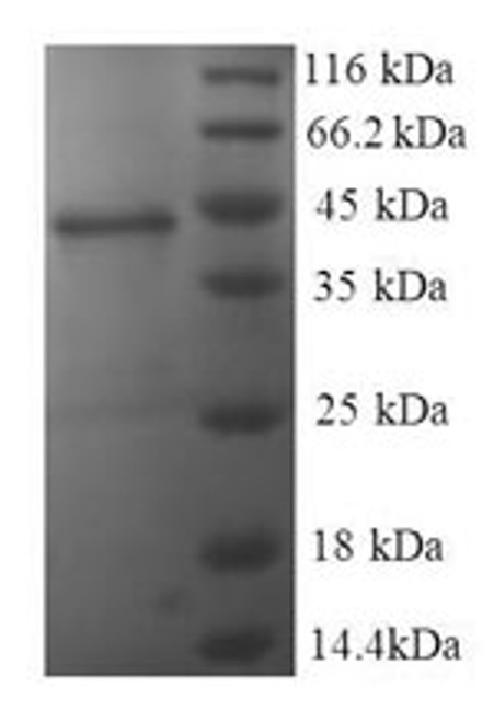 Recombinant Human Nucleoside diphosphate kinase A (NME1) (CSB-EP015884HU)