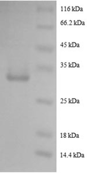 Recombinant Human Pro-epidermal growth factor (EGF)
, partial (CSB-EP007473HU1)