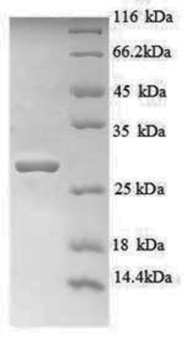 Recombinant Human Titin (TTN), partial (CSB-EP025267HU1(F6))
