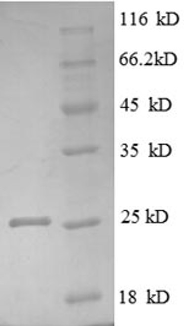 Recombinant Human Tumor necrosis factor receptor superfamily member 3 (LTBR), partial (CSB-EP013227HU1)