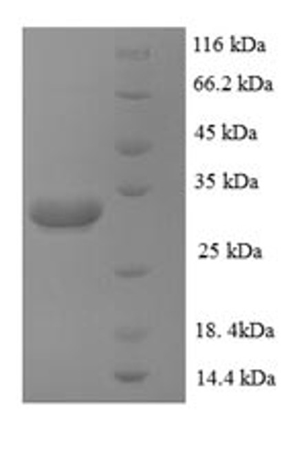 Recombinant Human Zinc transporter ZIP1 (SLC39A1), partial (CSB-EP885760HU)