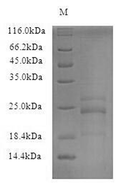 Recombinant Mouse Interleukin-23 subunit alpha (Il23a) (CSB-CF863641MOd7)