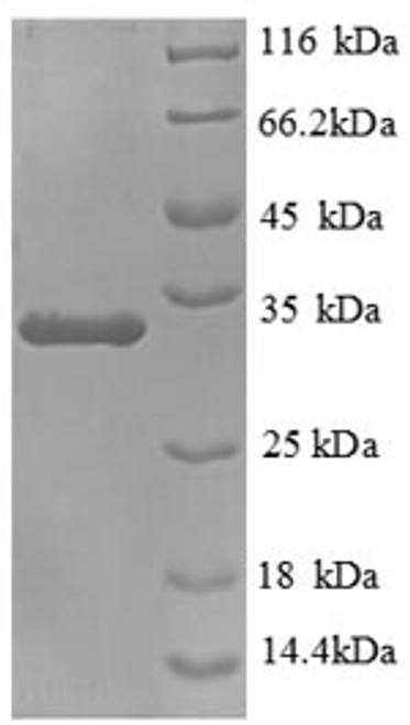 Recombinant Mouse Mucin 5, subtypes A and C, tracheobronchial/gastric (Muc5ac), partial (CSB-EP1722MO)
