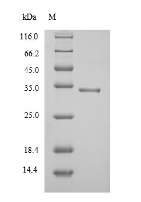 Recombinant Mycobacterium tuberculosis Diacylglycerol acyltransferase/mycolyltransferase Ag85A (fbpA), partial (CSB-EP358584MVZ1)