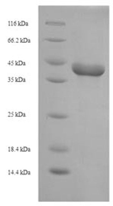 Recombinant Rhizomucor miehei Lipase (D250G) (CSB-EP321696RDA(M)) Recombinant Rhizomucor miehei Lipase (D250G) (CSB-EP321696RDA(M))