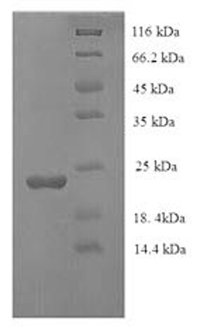 Recombinant Human Caspase-7 (CASP7), partial (CSB-EP004552HU1)