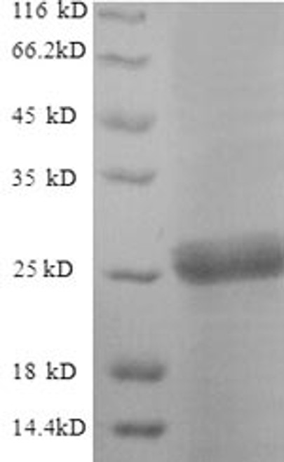 Recombinant Saccharomyces cerevisiae Neutral trehalase (NTH1), partial (CSB-EP330157SVG)