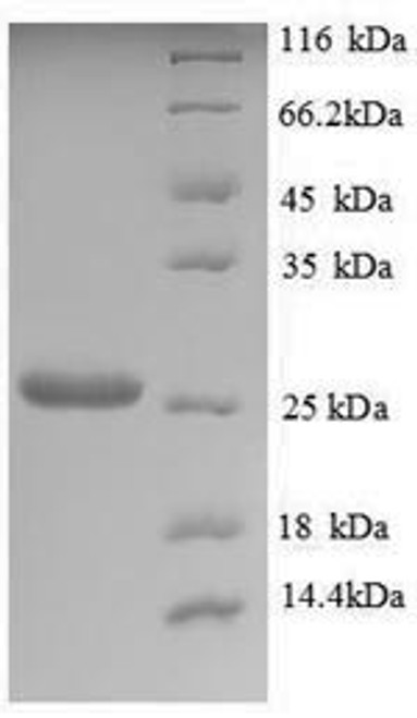 Recombinant Saccharomyces cerevisiae Trehalose-phosphatase (TPS2), partial (CSB-EP333628SVG1)