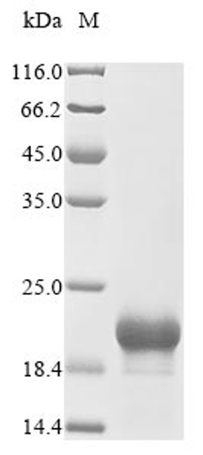 Recombinant Human CMRF35-like molecule 7 (CD300LB), partial (CSB-YP004919HUb0) Recombinant Human CMRF35-like molecule 7 (CD300LB), partial (CSB-YP004919HUb0)