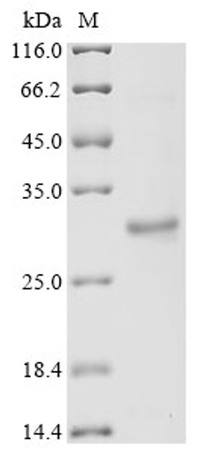 Recombinant Mouse Growth/differentiation factor 15 (Gdf15) (CSB-EP859530MO) Recombinant Mouse Growth/differentiation factor 15 (Gdf15) (CSB-EP859530MO)