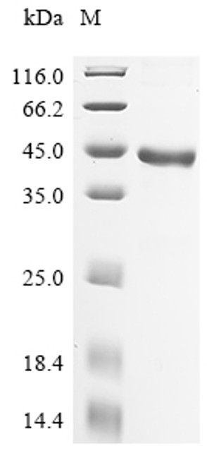 Recombinant Human Prostatic acid phosphatase (ACP3), partial (CSB-EP001181HU1(F2)) Recombinant Human Prostatic acid phosphatase (ACP3), partial (CSB-EP001181HU1(F2))