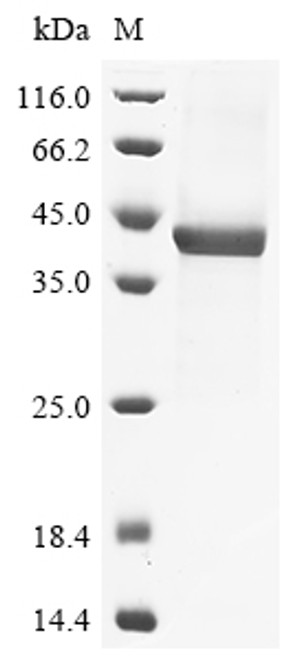 Recombinant Human Prostatic acid phosphatase (ACP3), partial (CSB-BP001181HU1(F2)) Recombinant Human Prostatic acid phosphatase (ACP3), partial (CSB-BP001181HU1(F2))
