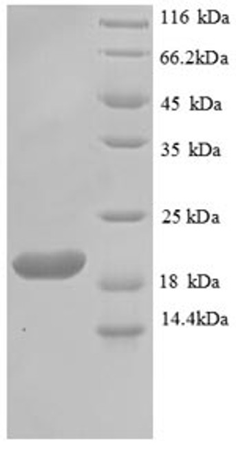Recombinant Toxoplasma gondii Profilin (PRF) (CSB-EP1510TOV) Recombinant Toxoplasma gondii Profilin (PRF) (CSB-EP1510TOV)
