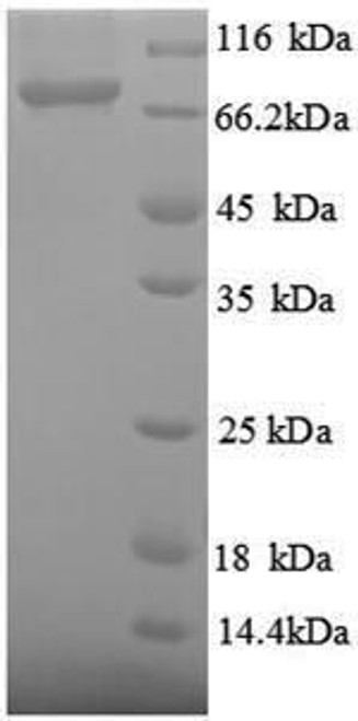 Recombinant Thermus aquaticus DNA polymerase I, thermostable (polA), partial (CSB-EP323156TNNe1) Recombinant Thermus aquaticus DNA polymerase I, thermostable (polA), partial (CSB-EP323156TNNe1)