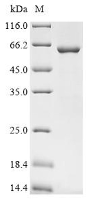 Recombinant Mouse Apoptosis inhibitor 5 (Api5) (CSB-EP001904MO) Recombinant Mouse Apoptosis inhibitor 5 (Api5) (CSB-EP001904MO)