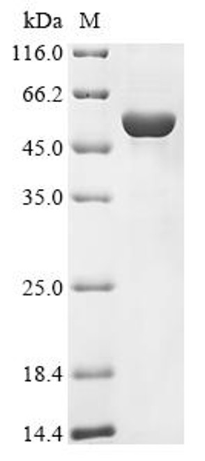 Recombinant Human Potassium-transporting ATPase alpha chain 1 (ATP4A), partial (CSB-EP002342HU)