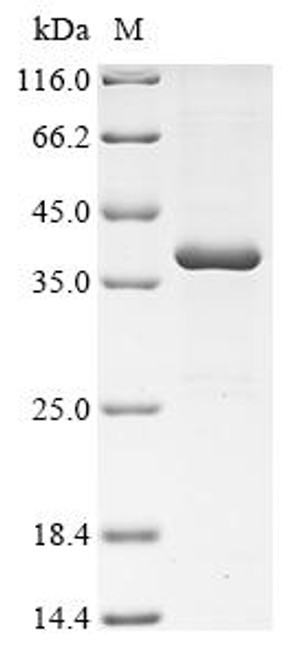 Recombinant Human OX-2 membrane glycoprotein (CD200), partial (CSB-EP004895HU1)