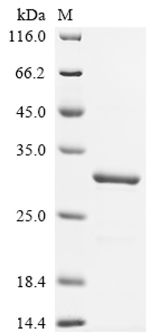 Recombinant Mouse Cytochrome c oxidase subunit 5A, mitochondrial (Cox5a) (CSB-EP005836MO)