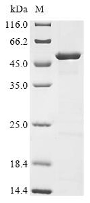 Recombinant Rickettsia australis Citrate synthase (gltA), partial (CSB-EP006031RMQ)