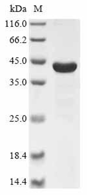 Recombinant Rat Cathepsin D (Ctsd) (CSB-EP006187RA)
