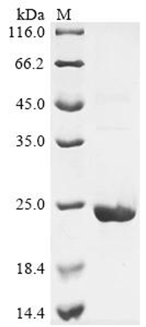 Recombinant Human D-dopachrome decarboxylase-like protein (DDTL) (CSB-EP006599HU)