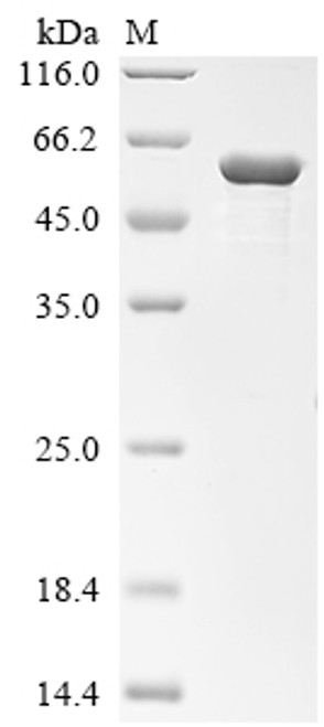 Recombinant Human Desmin (DES) (CSB-EP006735HUb0)