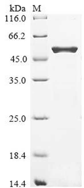 Recombinant Escherichia coli O157:H7 Dihydrolipoyllysine-residue succinyltransferase component of 2-oxoglutarate dehydrogenase complex (sucB) (CSB-EP006950EOD)