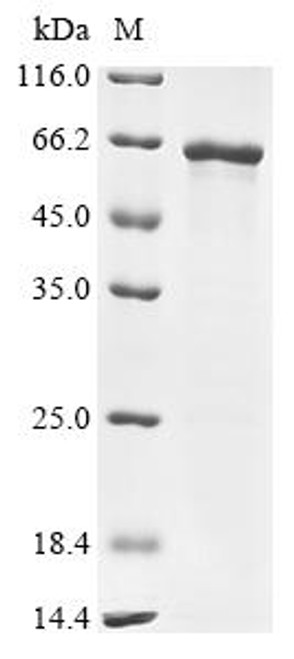 Recombinant Mouse Coagulation factor X (F10) (CSB-EP007915MO)