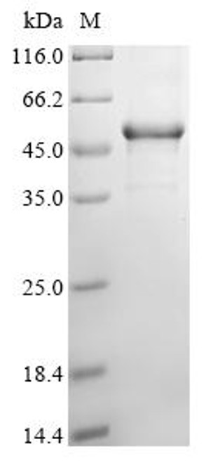 Recombinant Human Forkhead box protein L2 (FOXL2) (CSB-EP008827HU)
