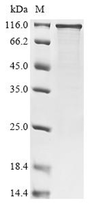 Recombinant Human RNA-binding protein FUS (FUS) (CSB-EP009069HUe7)